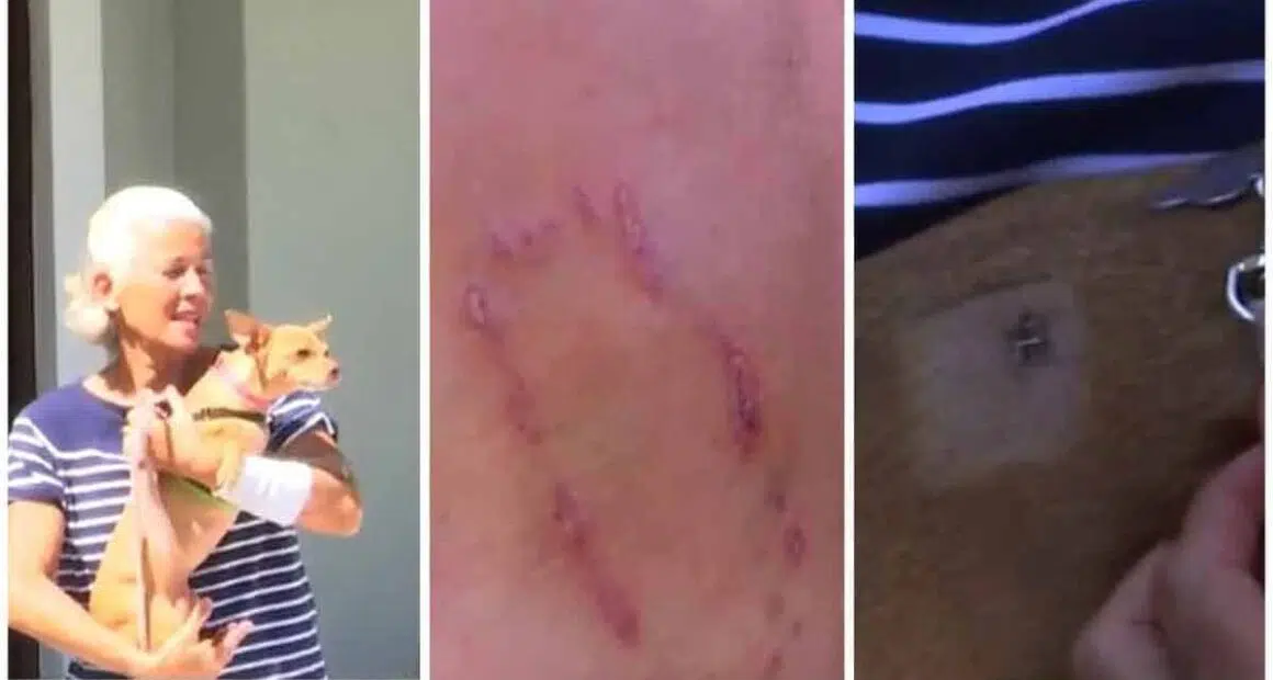 The family looks for justice after a neighbors chihuahua attacks a woman