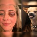 Woman Had Eyelid Ripped Off by Chihuahua