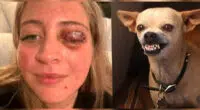 Woman Had Eyelid Ripped Off by Chihuahua - Chihuacorner.com