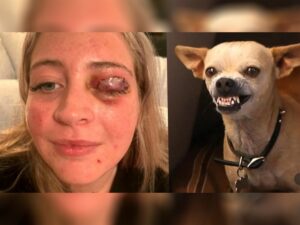 Read more about the article Woman Had Eyelid Ripped Off by Chihuahua