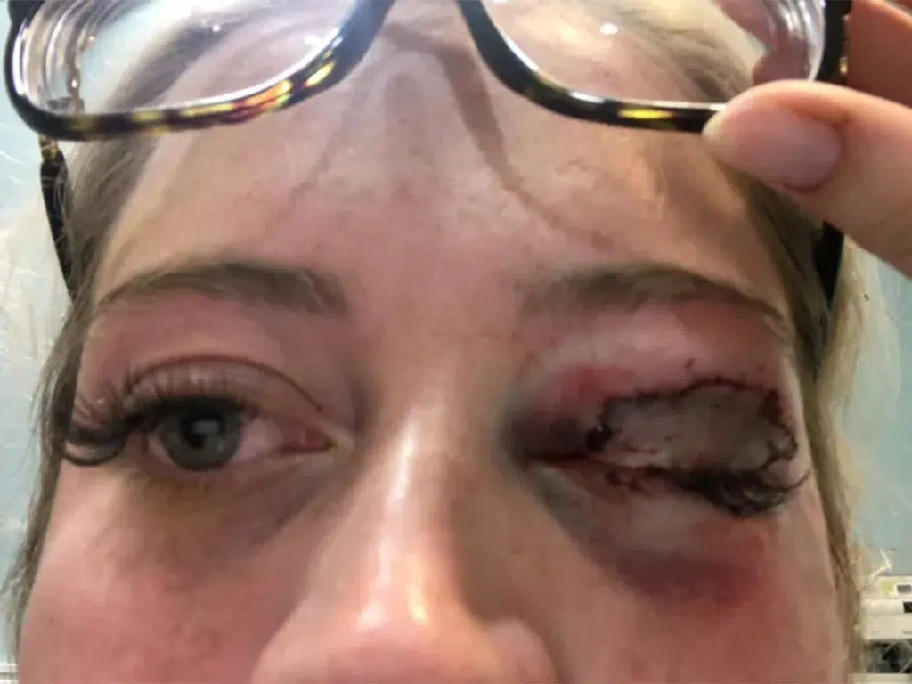 Chihuahua eyelid ripped off - illustrated by the girl who fell victim to the incident